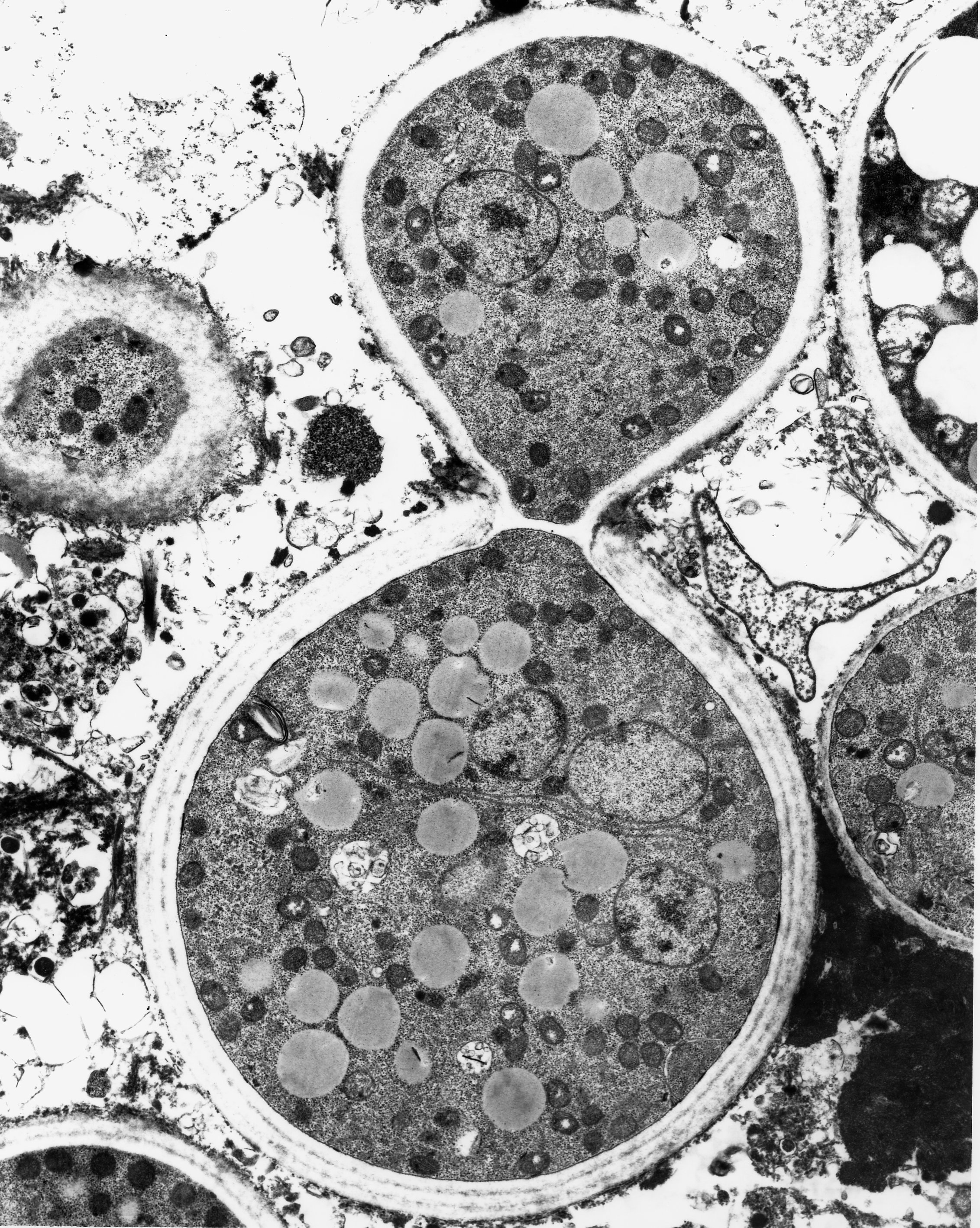 Transmission Electron Microscopy Of Yeast Cells Treat - vrogue.co
